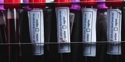 ویروس کرونا   تحقیقات علمی   پاندمی   چین   ایالات متحده امریکا